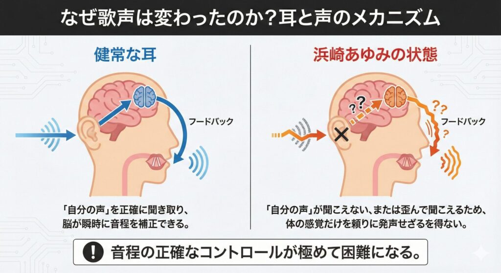 突発性内耳障害が歌唱に与える影響を示した図解。健常な耳が音を正確にフィードバックできるのに対し、障害のある耳ではそのループが機能しないことを示している。